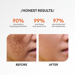 Co Beauty Co Glow Pigmentation Serum