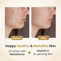 Co Luxury Co Gluta Forte Glutathione Tablet with Vitamin C & Alpha Lipoic Acid | 10 Tablets