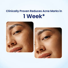 Co Beauty Foaming Face Wash With Salicylic & Glycolic Acid