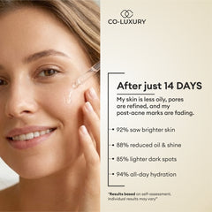 CO LUXURY 10% Niacinamide Face Serum | Oil Control, Pore Refining & Dark Spot Care | Barrier Support | 30ml