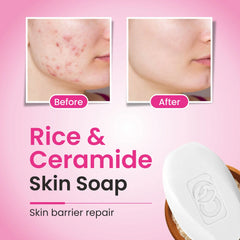 CO Luxury Rice & Ceramide Glass Skin Soap – Nourishing & Moisturizing Bar | Pack of 2 (75gx2)